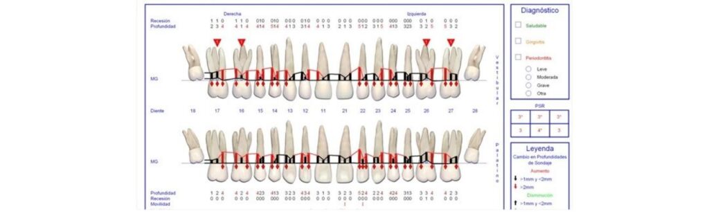 tratamiento periodontal sevilla