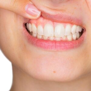 tratar periodontitis sevilla
